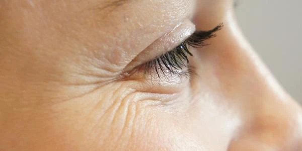 علاج التجاعيد في المنزل