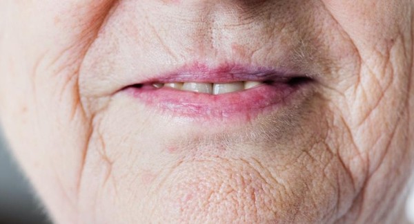 علاج التجاعيد في المنزل