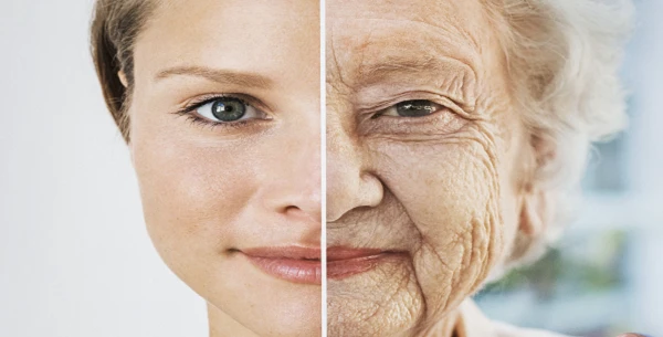 علاج التجاعيد في المنزل