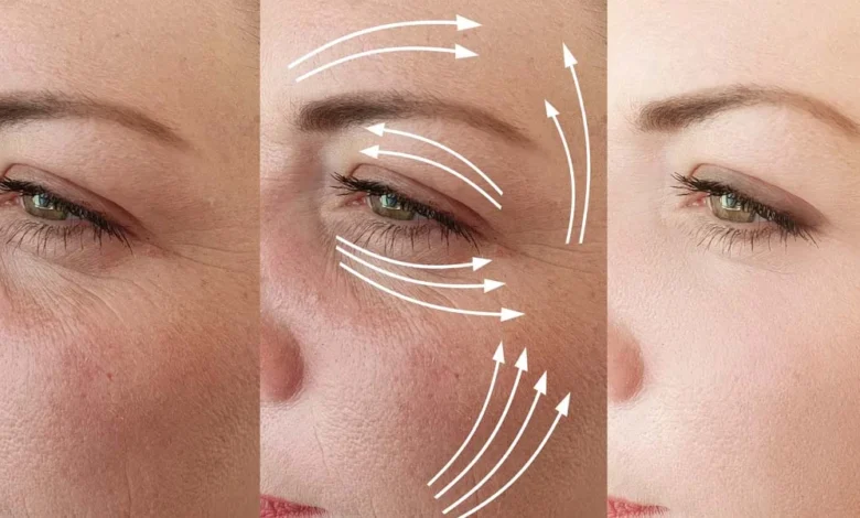 علاج التجاعيد في المنزل