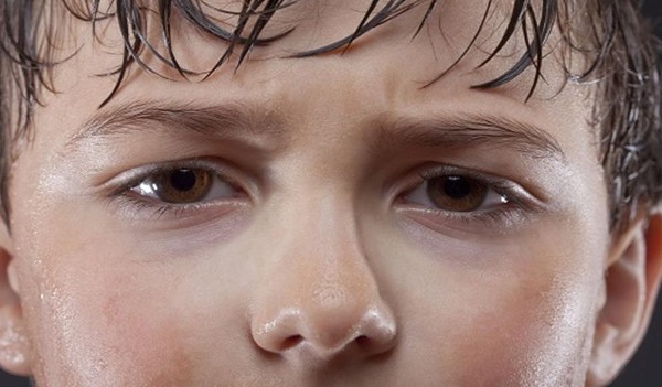 أسباب التعرق المفاجئ