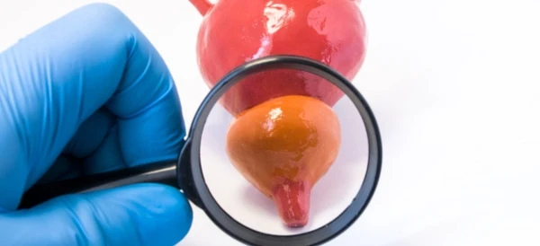 التهاب البروستاتا المزمن