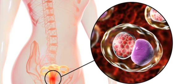 جرثومة الحمل