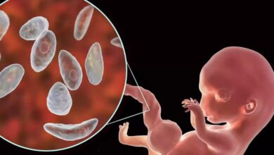 جرثومة الحمل