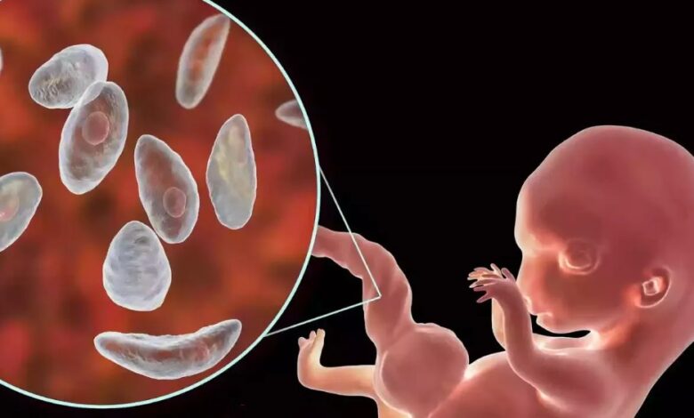 جرثومة الحمل