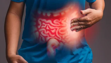 علاج القولون العصبى