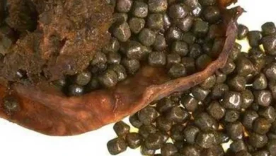 علاج حصى المرارة