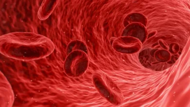 علاج فقر الدم