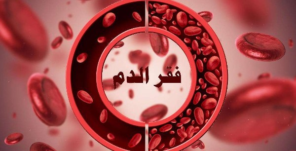 علاج فقر الدم