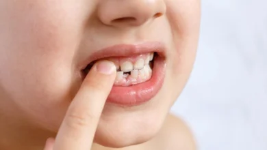 تفسير حلم وقوع الأسنان