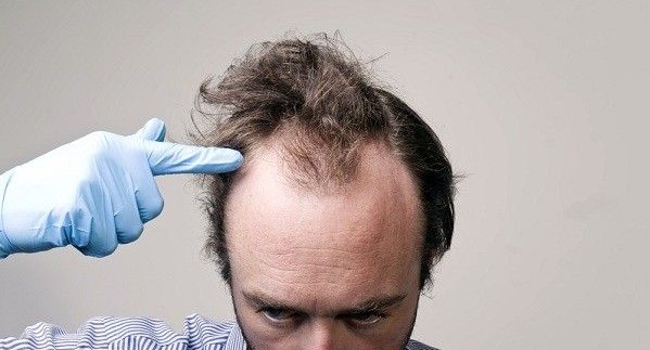 أفضل امبولات للشعر الخفيف