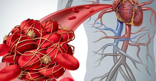 تخثر دم الجنين