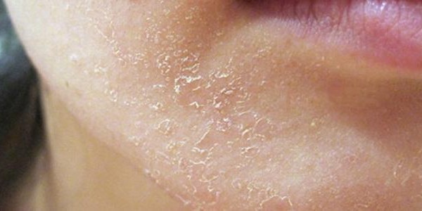 كريم تقشير الوجه