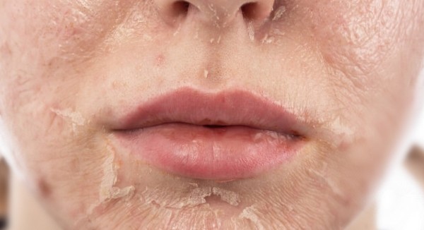 كريم تقشير الوجه