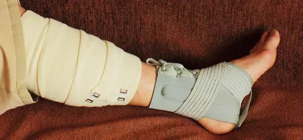 علاج تمزق الأربطة