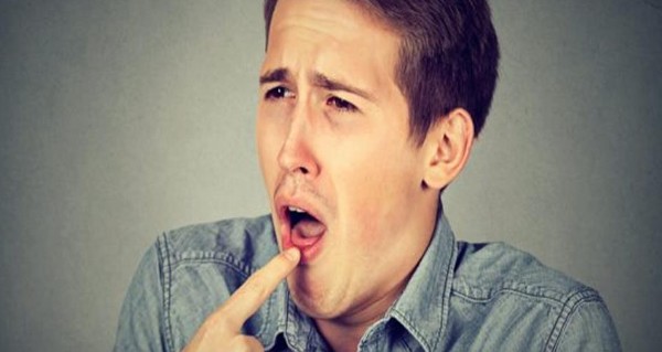 أسباب مرارة الفم